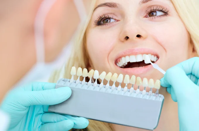 Teeth Whitening – What You Need to Know Before, During and After a Teeth Whitening Treatment